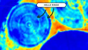 Satellitenanalyse zeigt helle Ringe auf einem Pivot-Feld als Hinweis auf Düsenverstopfung - FarmBooker App